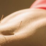 electrolipolisis