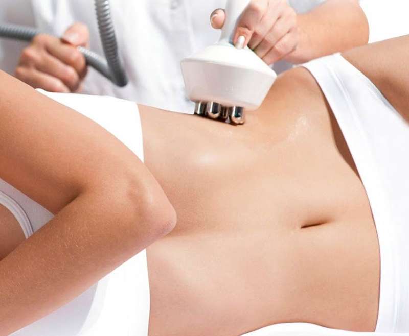 radiofrecuencia-abdomen